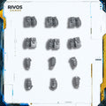 Warhammer 40K Death Korps of Krieg Grenades - Bits (Bitz)
